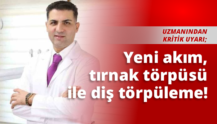 Yeni akım, tırnak törpüsü ile diş törpüleme!